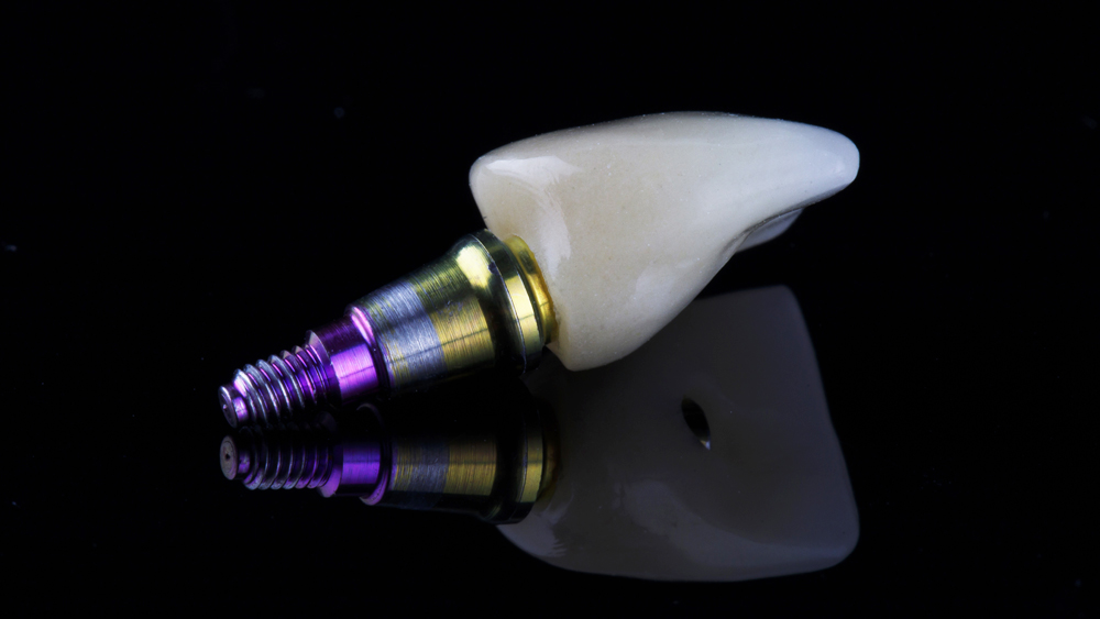 Merlin-dental-laboratory_Service_custom-abutments