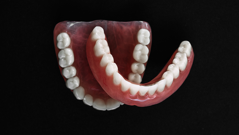 black dental model of the jaw with a bridge prosthesis and zirco